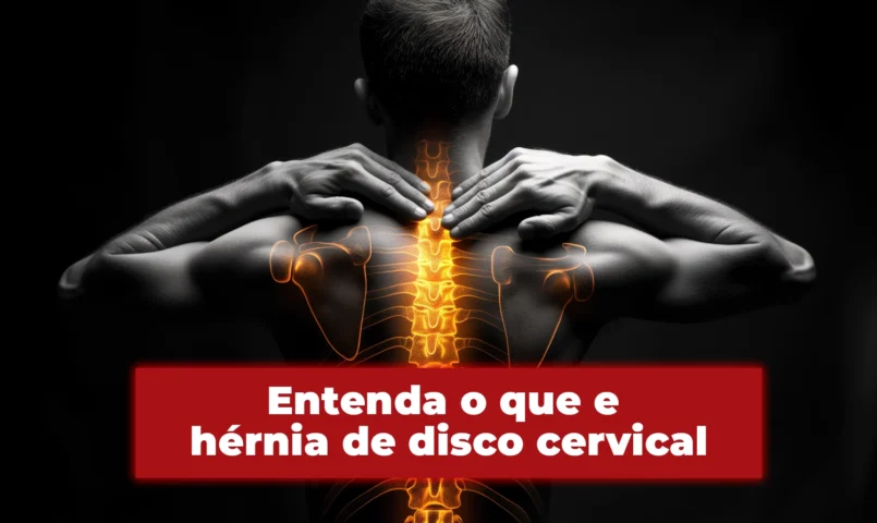 Entenda o que é hérnia de disco cervical