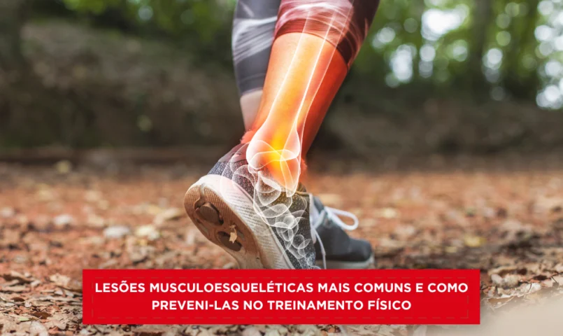 Lesões Musculoesqueléticas Mais Comuns e Como Preveni-las no Treinamento Físico