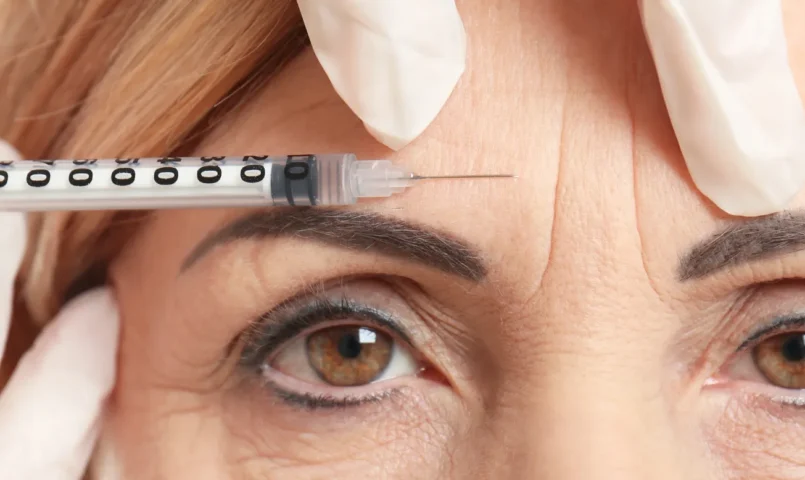 Tudo sobre botox: O que é, Como Funciona e Quando Usar