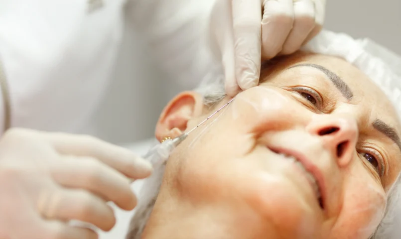 Bioestimuladores na Estética avançada: Como Funcionam e Por Que Estão em Alta?