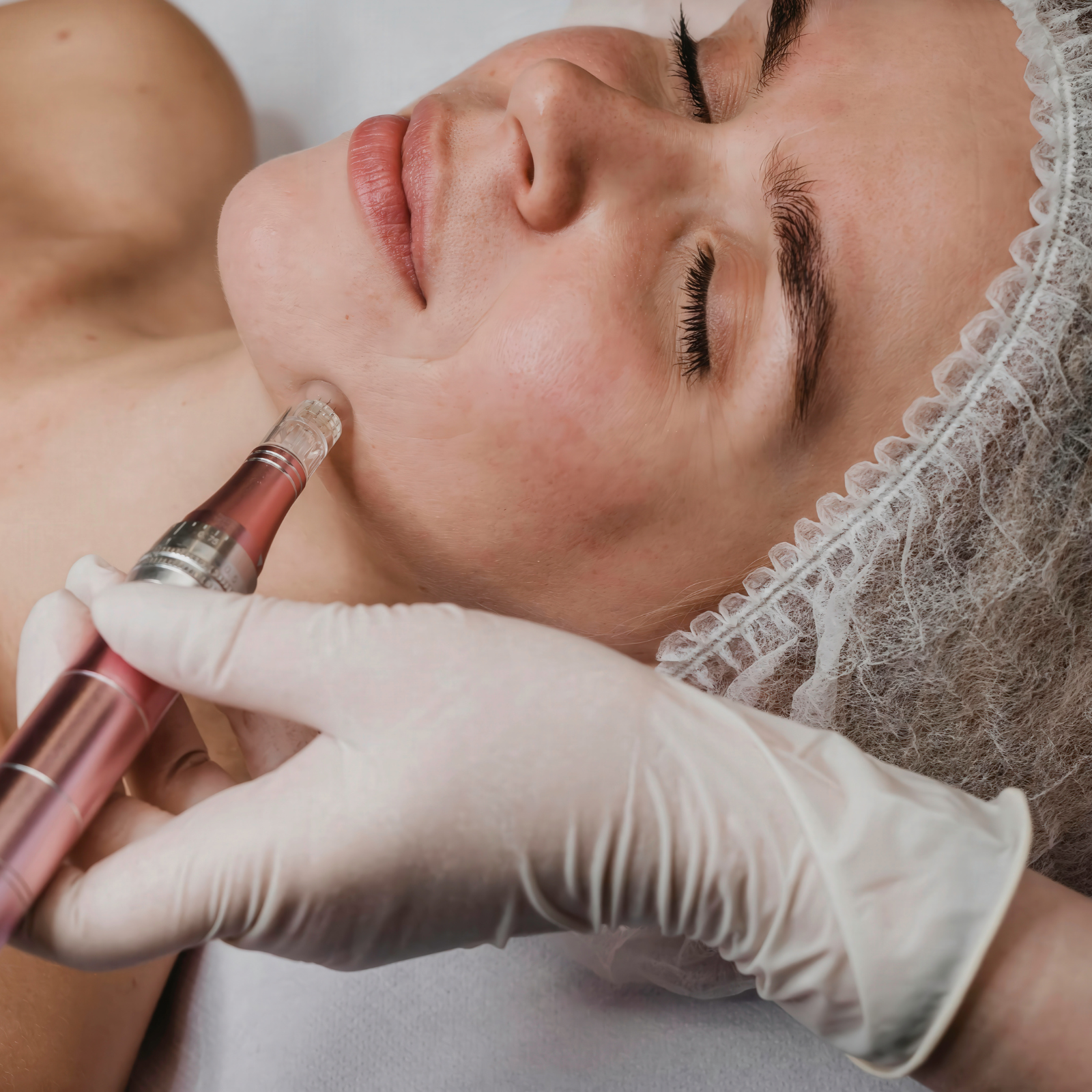 procedimento facial em terapias combinadas