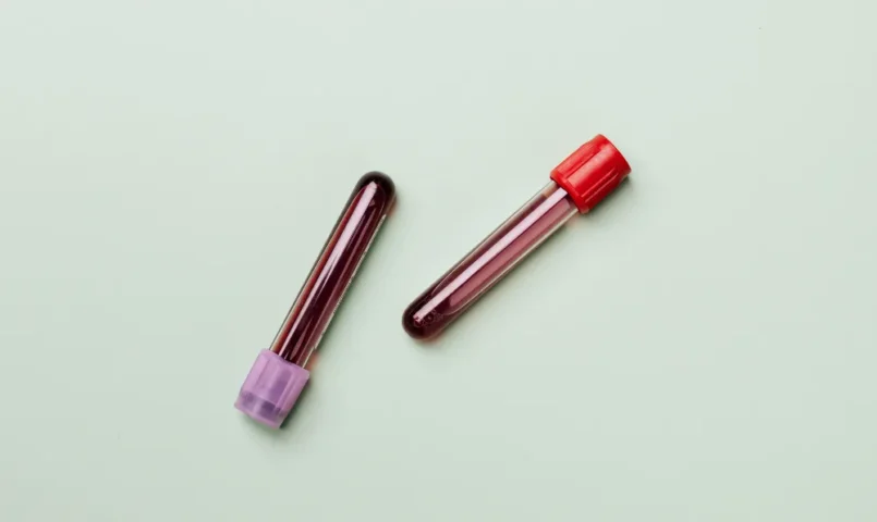 Laser Inteligente e Jato de Plasma 2.0: tecnologias híbridas para resultados mais seguros