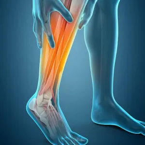 Análise clínica da fratura por estresse tibial no esporte